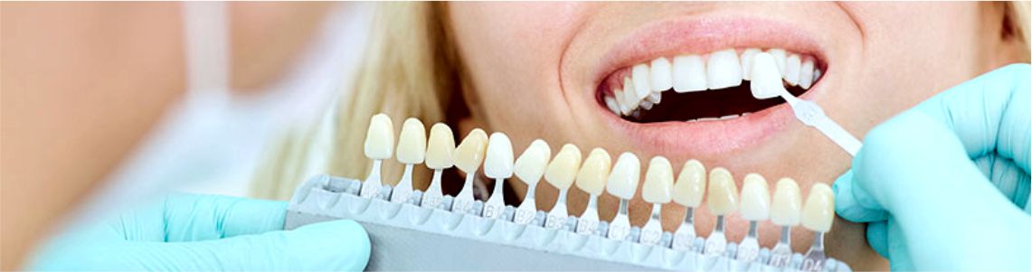 Cosmetic Dentistry In Delhi