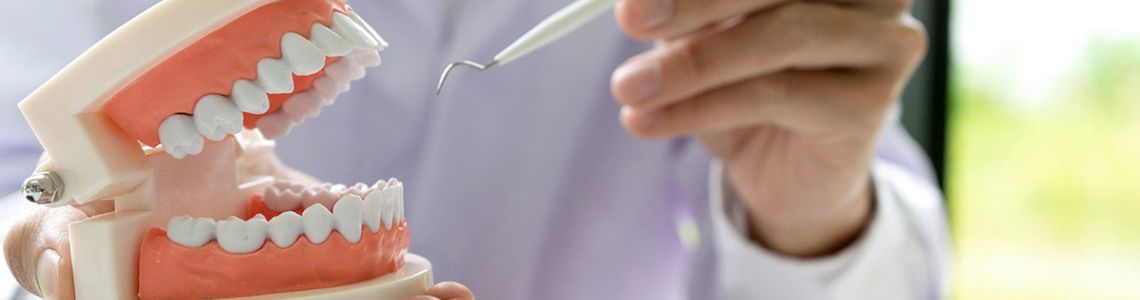 Full Mouth Rehabilitation In Delhi